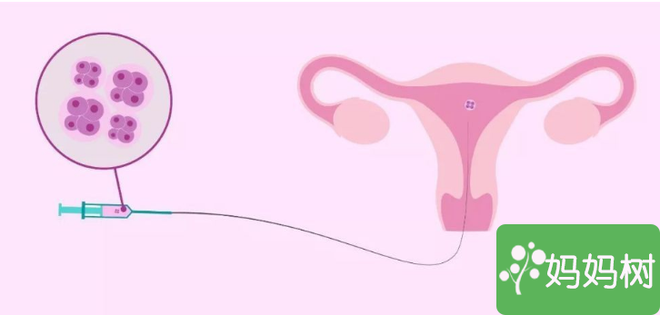 试管婴儿胚胎放入子宫疼吗(图1)
